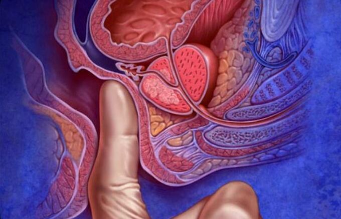 Massage de la prostate